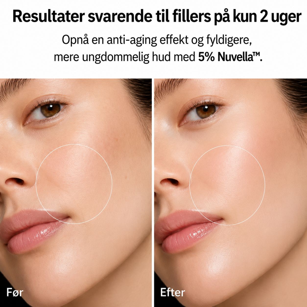 Nuvella™ - Fastere, fyldigere hud på kun 7 nætter!