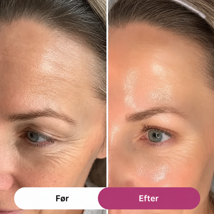 Volyra™ - PDRN Collagen Volume Balm 2.0