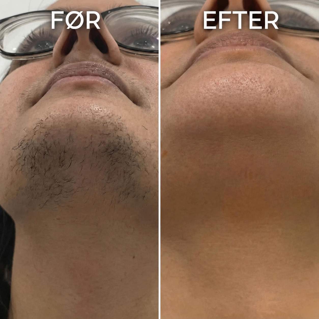 Velisse™ Botanisk Serum Mod Hårvækst