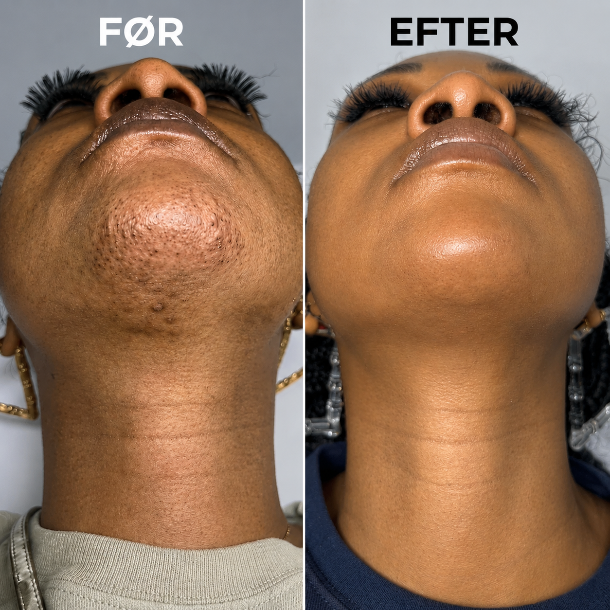 Velisse™ Botanisk Serum Mod Hårvækst
