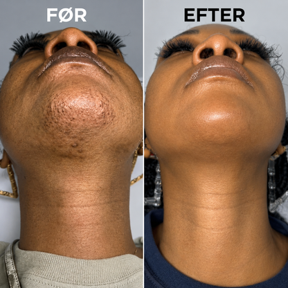 Velisse™ Botanisk Serum Mod Hårvækst