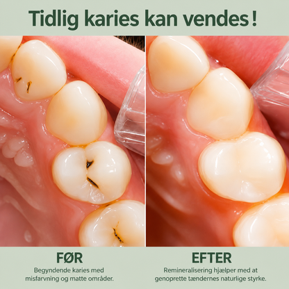 BirkTyg™ – Remineraliserende tyggegummi