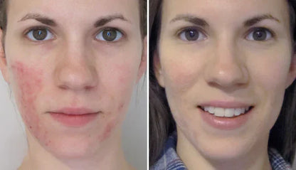 Velventh™ – Det beroligende serum mod rødme og irritation