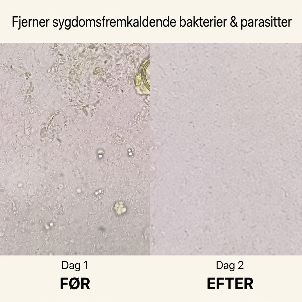 TarmRen™ - Fjern parasitter, rens dine tarme & føl dig lettere