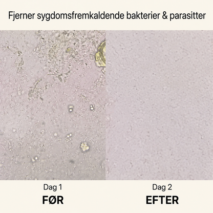 TarmRen™ - Fjern parasitter, rens dine tarme & føl dig lettere