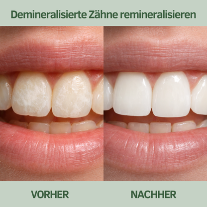BirkTyg™ – Remineraliserende tyggegummi