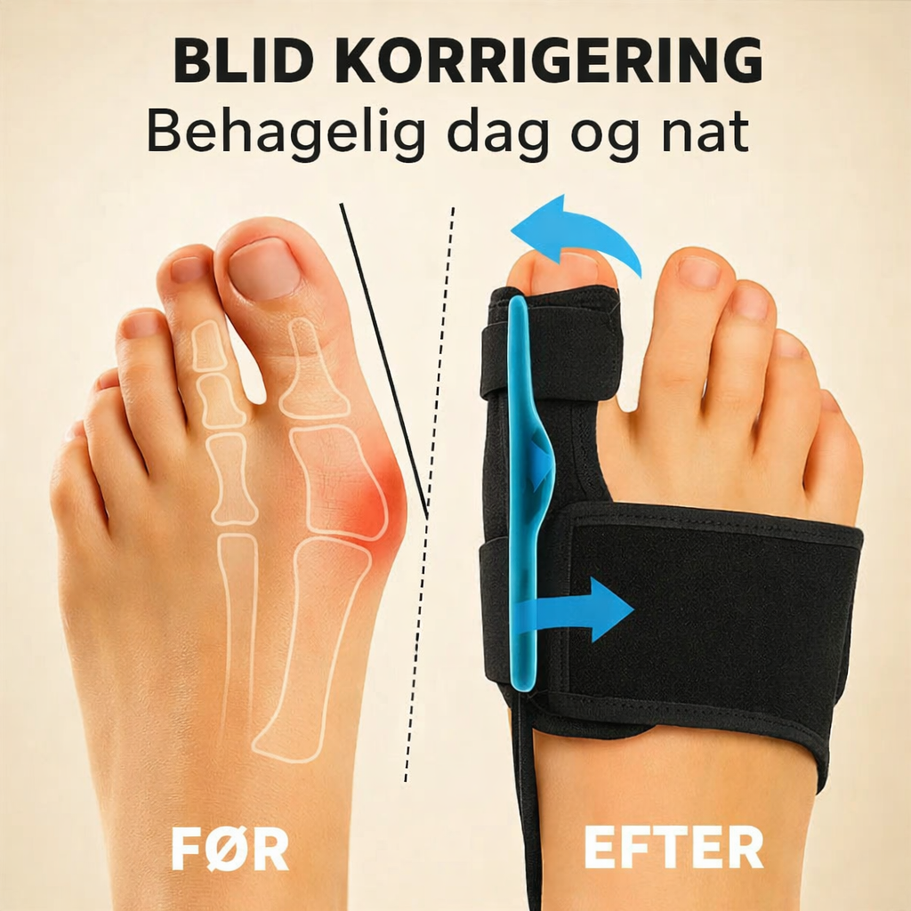 OrthoStep™ – Komfortabel korrektion og støtte til hallux valgus (1+1 GRATIS)