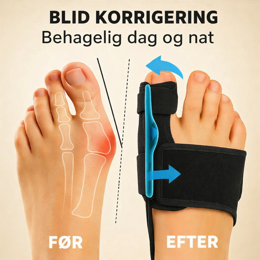 OrthoStep™ – Komfortabel korrektion og støtte til hallux valgus (1+1 GRATIS)