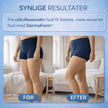 DermaForm™ | Reducér Synlig Cellulite Hjemme på 10 Minutter