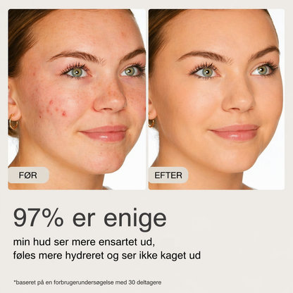 BeautyBlur™ - Udjævner huden med det samme