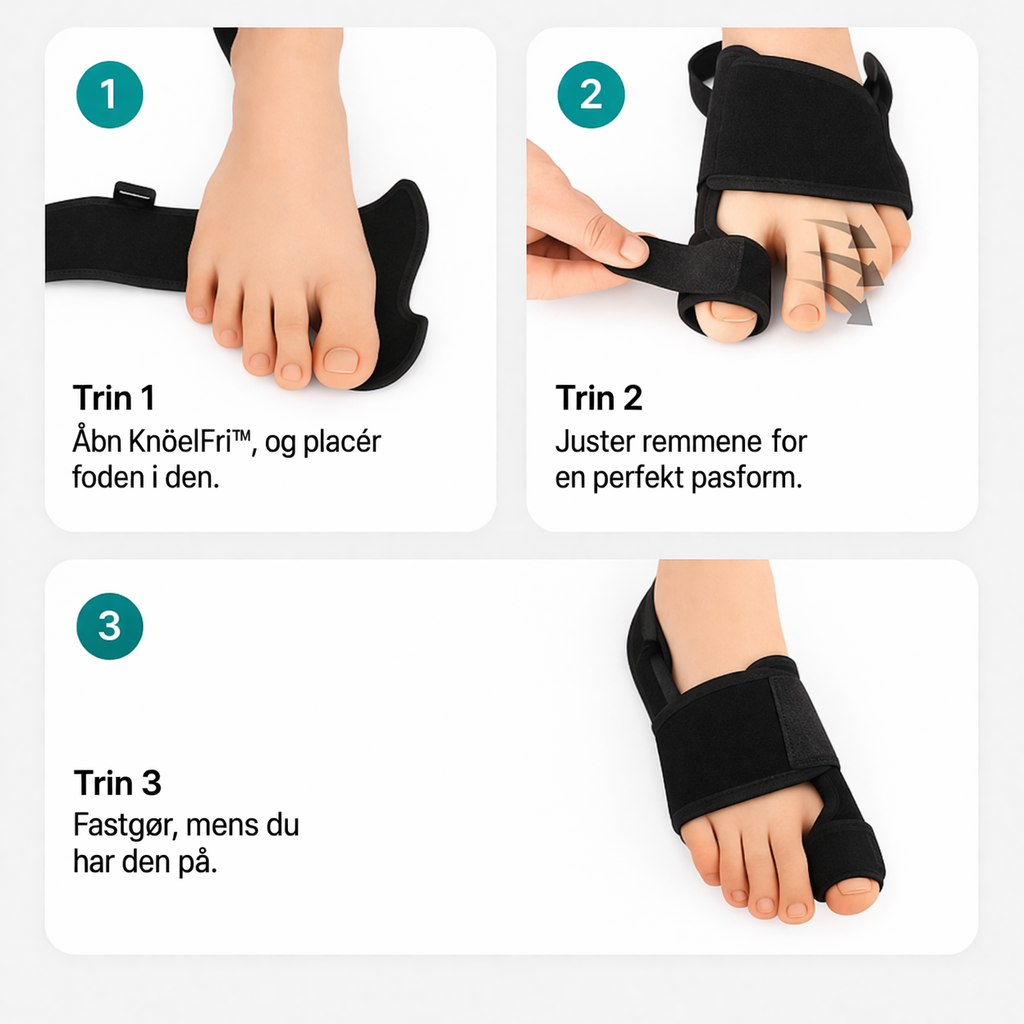 OrthoStep™ – Komfortabel korrektion og støtte til hallux valgus (1+1 GRATIS)