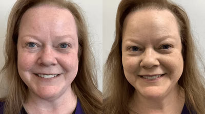 Velventh™ – Det beroligende serum mod rødme og irritation