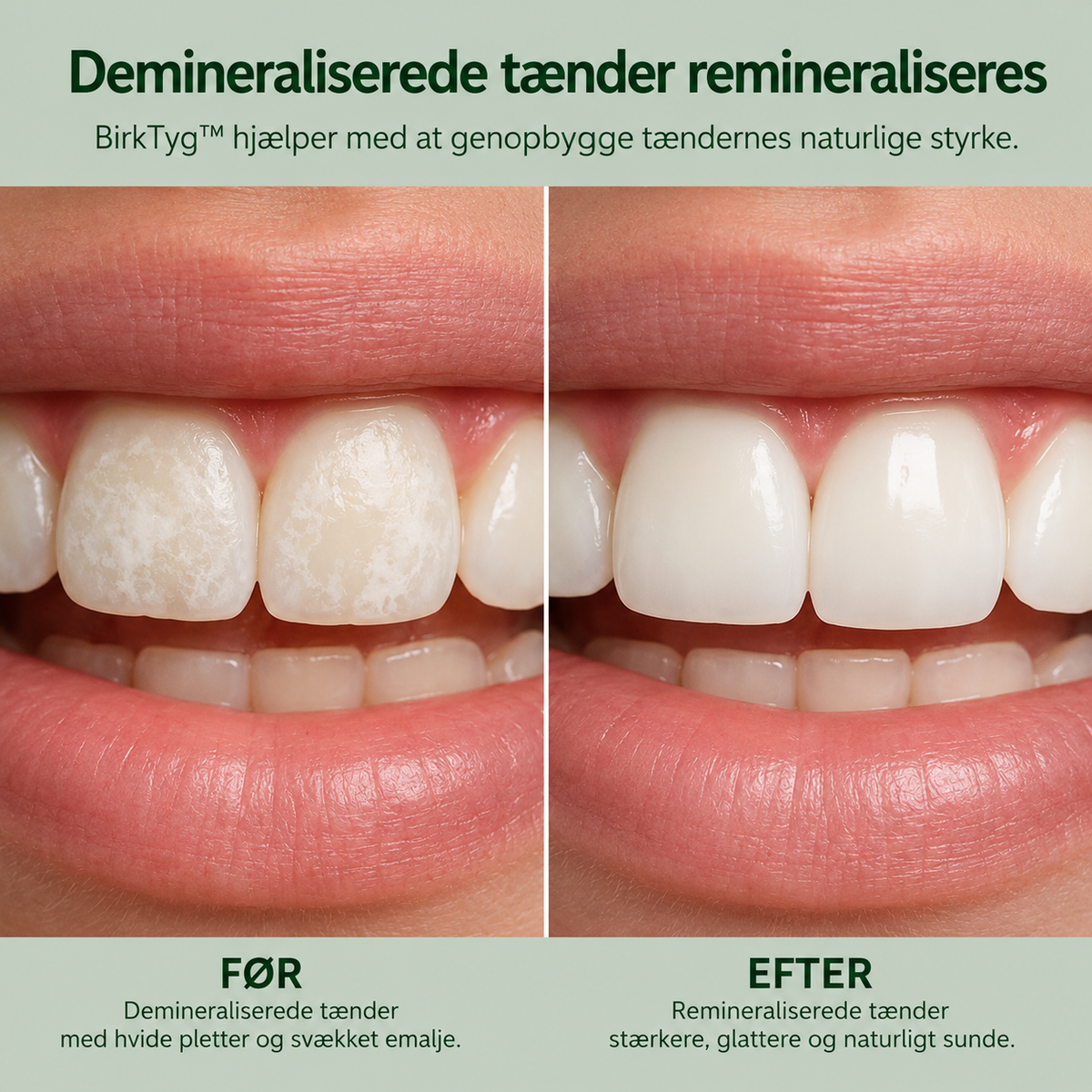 BirkTyg™ – Remineraliserende tyggegummi
