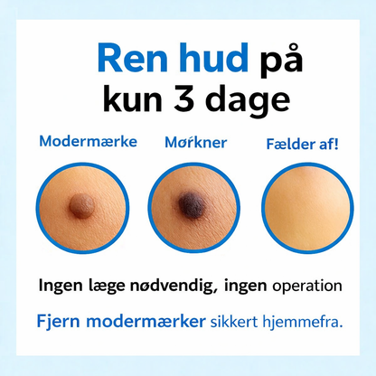 Skinova™ - Slip af med hudvedhæng hurtigt og smertefrit